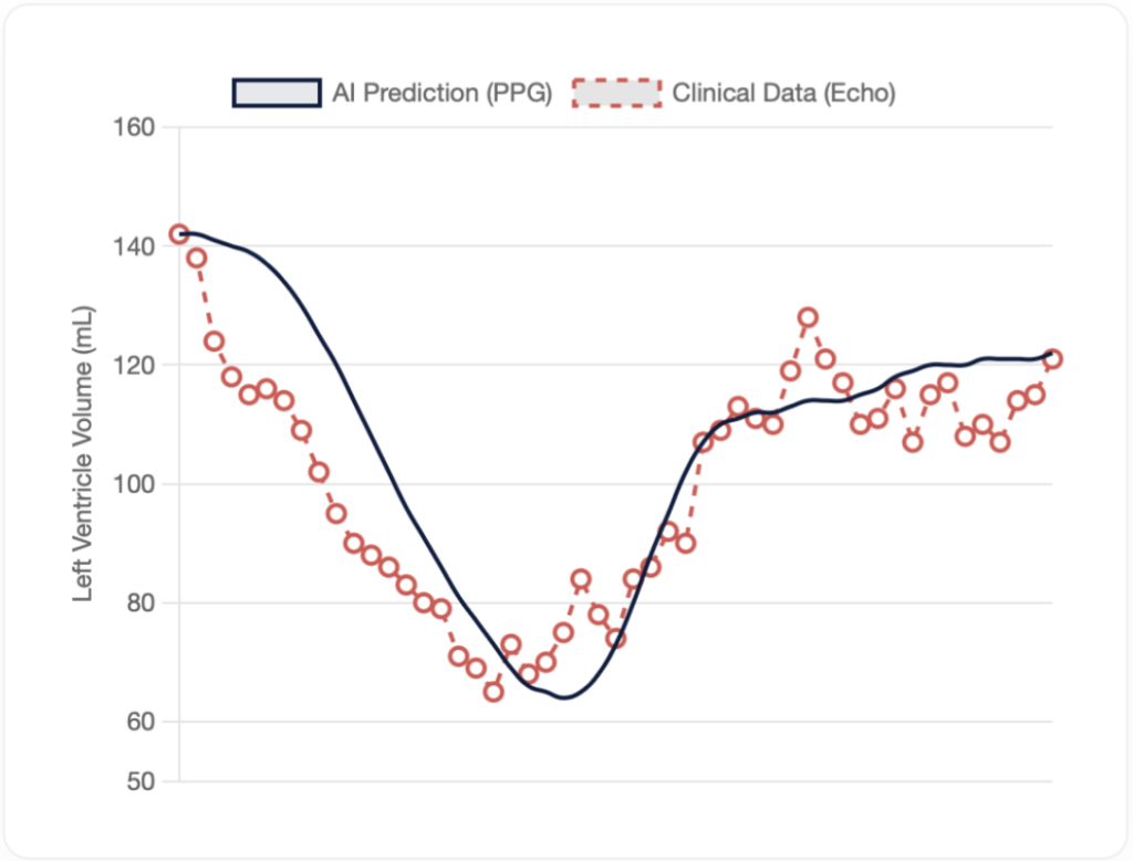 Graphique analyse ultrason entre IA et Medrik